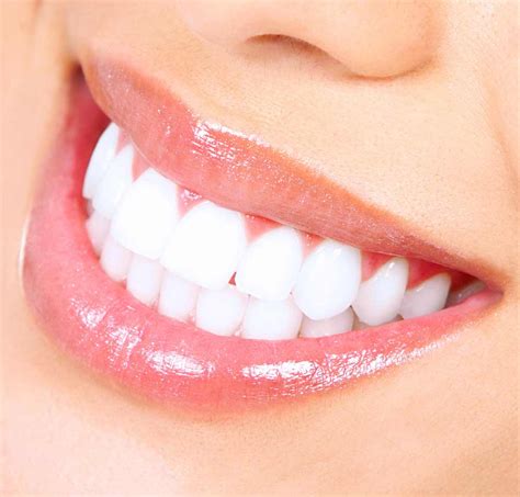 Teeth Whitening In Poway Brighten Your Smile Today