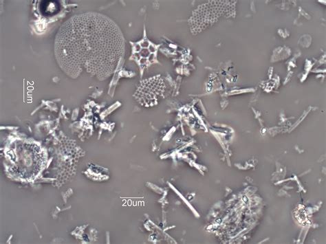 Diatomaceous Earth Celite 535 Under The Microscope