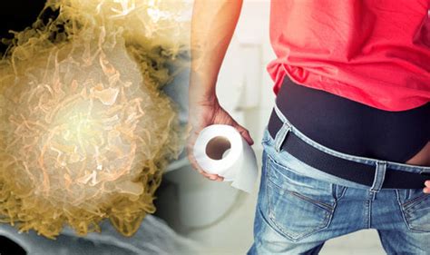 Cancer that's started to break out of the prostate, or has spread to the area just outside it. Prostate cancer symptoms: Signs when you go to urinate ...