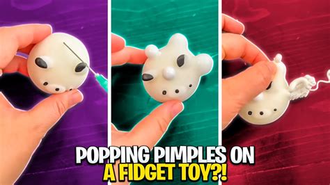 Popping Pimples On A Fidget Toy 🫢 Mrs Bench Youtube