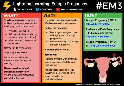 Lightning Learning Ectopic Pregnancy Em