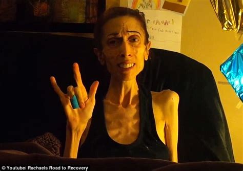 Anorexic Actress Rachael Farrokh Thanks The Public For Fundraising