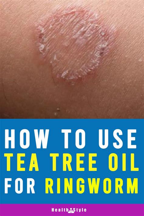 Tea Tree Oil For Ringworm In 2020 Tree Oil Tea Tree Tea Tree Oil