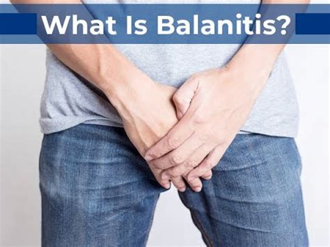Balanitis Symptoms And Causes Diagnosis Treatment Prevention Youtube