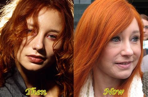 Tori Amos Plastic Surgery Before And After Latest Plastic Surgery Gossip And News Plastic