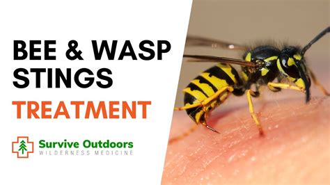 How To Treat Bee And Wasp Stings Youtube