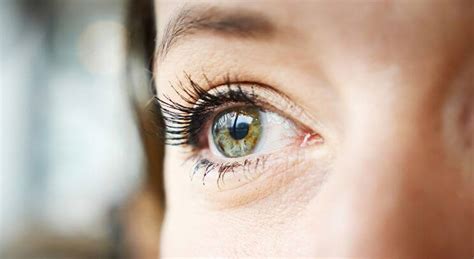 Freckles In The Eye Eye Center In Plano Brooks Eye Associates