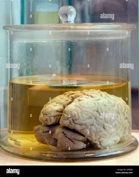 Real Human Brain In A Glass Jar Stock Photo Royalty Free