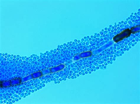 Fun With Microbiology Whats Buggin You Aureobasidium Pullans