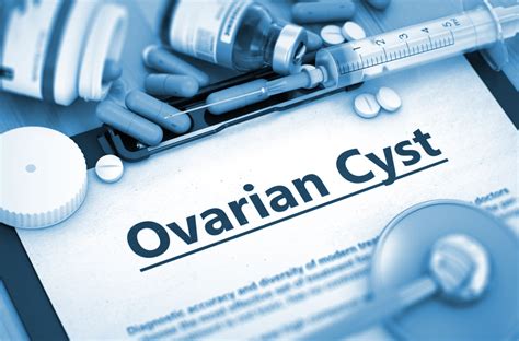 Ovarian Cysts Symptoms Causes And Treatment The Gynae Point