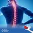 8 Things About Spinal Cord Injuries  Secure Healthcare Solutions