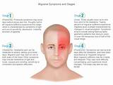 Pictures of Frontal Headache Treatment