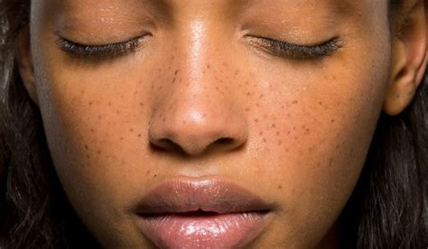 Faux Freckles Are A Thing And Heres How You Get Them NBGA MAG No