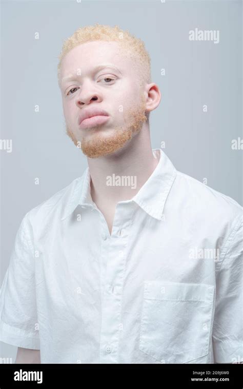 Studio Portrait Of Albino Man In White Shirt Stock Photo Alamy