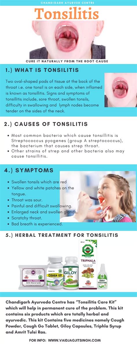 Ppt Tonsillitis Causes Symptoms And Herbal Treatment Powerpoint