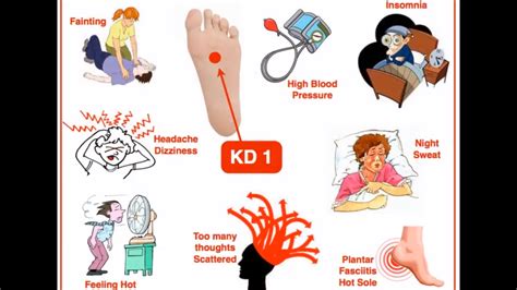 Kidney 1 Acupuncture Point Acupuncture Points Dizziness High Blood