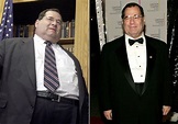 Jerry Nadler Before Weight Loss Surgery