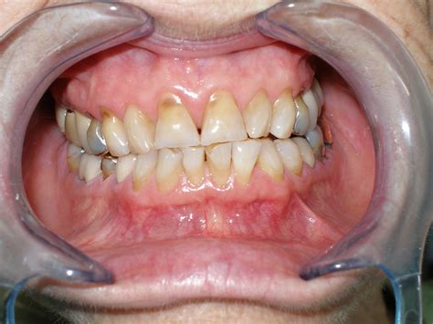 X01692 Laurene K Duke Dds Total Wellness Dentistry