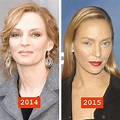Uma Thurman before and after plastic surgery 03 – Celebrity plastic ...