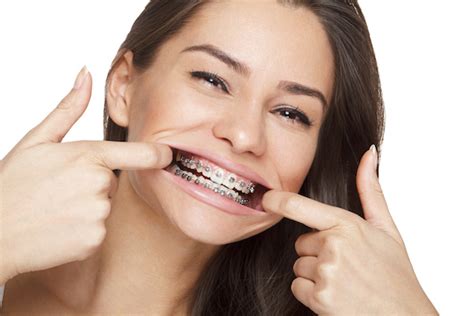 Braces Myths Busted Melbourne Orthodontics