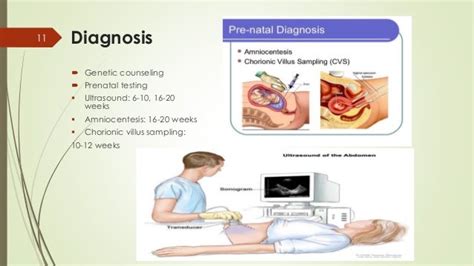 Genetic Disorders During Prenatal Development
