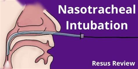 Nasotracheal Intubation Featured Image Resus Review