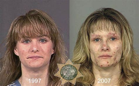 Estos Fotos De Antes Y Después De Las Drogas Son Completamente