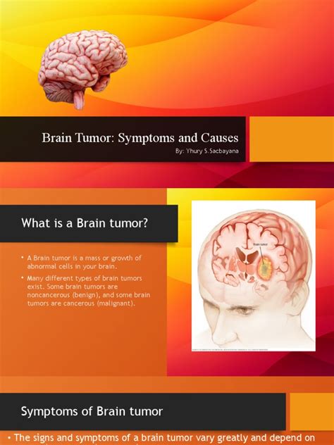 Brain Tumor Symptoms And Causes By Yhury Ssacbayana Pdf Brain