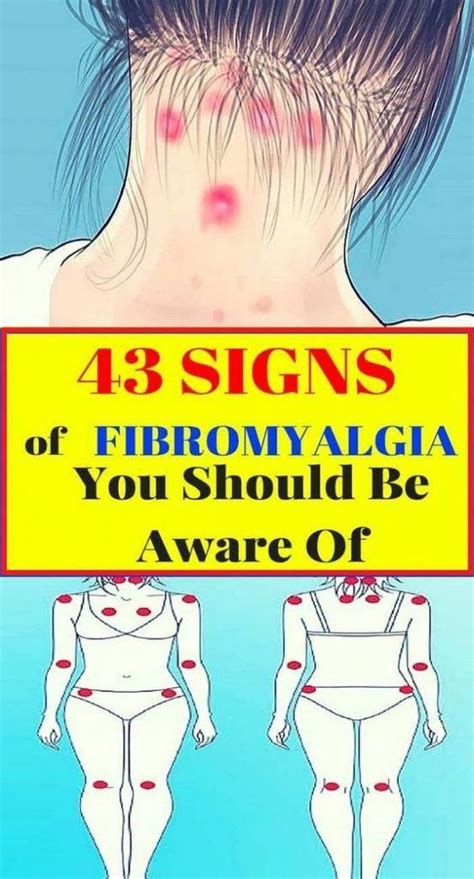 43 Signs Of Fibromyalgia You Should Be Aware Of Signs Of Fibromyalgia