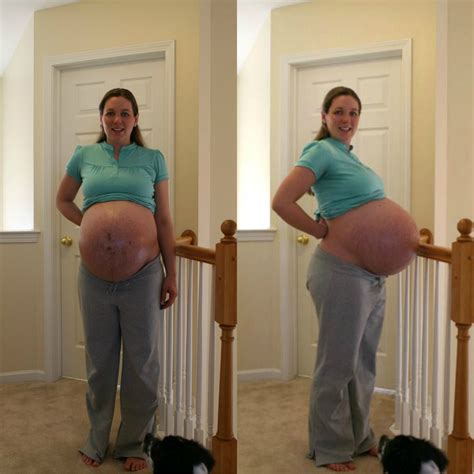 Triplet Pregnancy Pregnant With Triplets Belly Pregnant Belly Huge 39