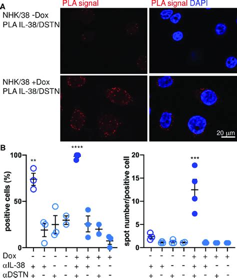 Interaction of IL-38 and DSTN in NHK/38 cells. A. A proximity ligation ...
