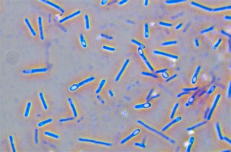Clostridium Botulinum Lm Photograph By Michael Abbey Pixels