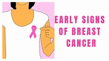 Early Signs Of Breast Cancer Every Women Should Know