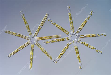 Tabellaria Fenestrata Light Micrograph Stock Image C0568355