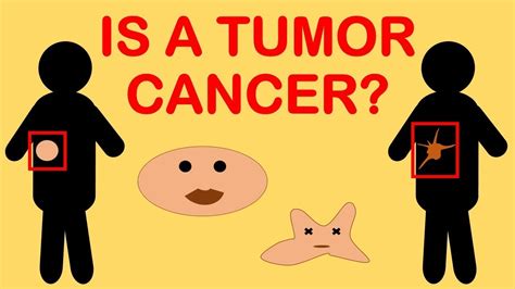 Is A Tumor Cancer Or Not Is There A Difference Between Cancer And