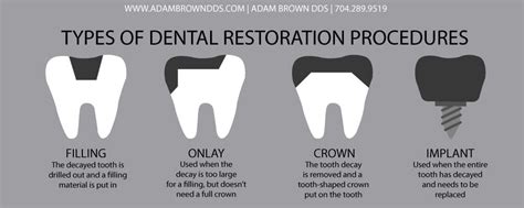 Restotative Dentistry Monroe Nc Adam Brown Dds