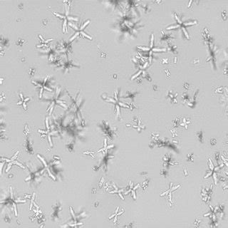 Differences in the free ca2+ in undiluted urine from stone formers and normal. Kidney Stone 70 Calcium Oxalate Monohydrate - kidneyoi