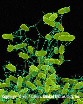 A number of its serovars are serious human pathogens. Salmonella enteritidis