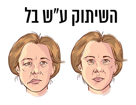 שיתוק מוחין נגרם באמצעות פיתוח או נזק חריג בחלק אחד או יותר של המוח השולטים בטונוס שרירים ופעילות תנועה, וגורמים לנזק. מהו השיתוק בו לקתה מיכל אנסקי?