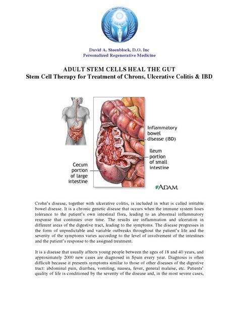 Adult Stem Cells Heal The Gut Ulcerative Colitis Crohns Disease