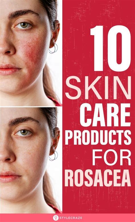 15 Best Skincare Products For Rosacea To Try In 2022 Rosacea Skin