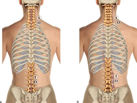 8 muscles of the spine and rib cage musculoskeletal key from musculoskeletalkey.com. 8. Muscles of the Spine and Rib Cage | Musculoskeletal Key