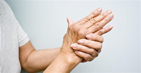 Artrite reumatoide conheça alguns