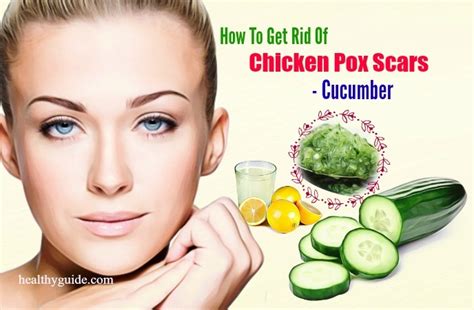 23 Tips How To Get Rid Of Chicken Pox Scars On Face Fast Naturally In