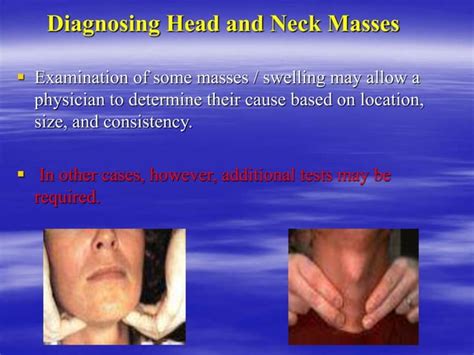 Differential Diagnosis Of Head And Neck Swelling