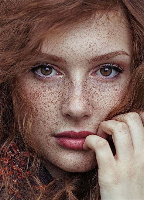 15 Freckled People Wholl Hypnotize You With Their Unique Beauty Bored Panda