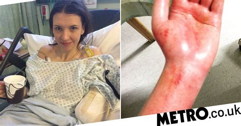 Models Arm Chopped Off After Being Electrocuted While Charging Her Laptop Metro News