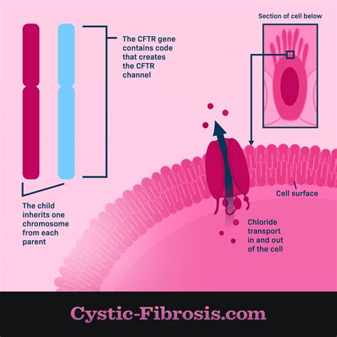 Cystic Fibrosis Chromosome 7