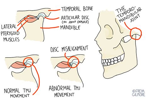 The Tmj Jaw Pain And Clicking Gemini Osteopathy