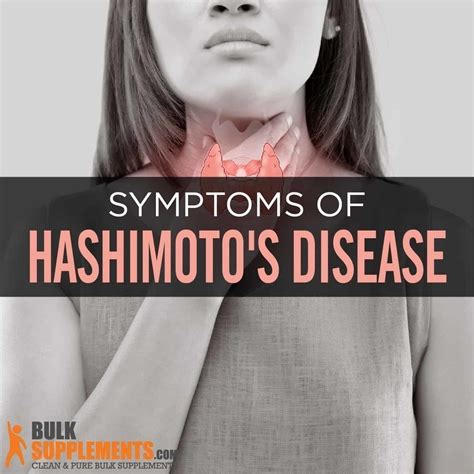 Tablo Read Hashimotos Disease Symptoms Causes And Treatment By